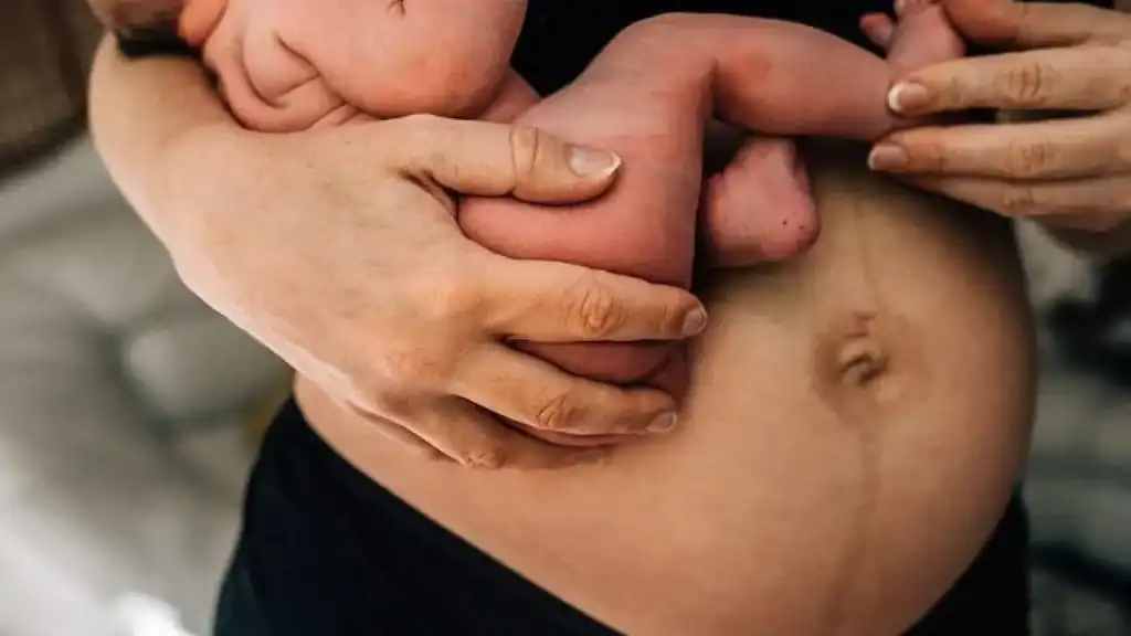 Why Is My Stomach Still Big After Pregnancy Kelvindale?